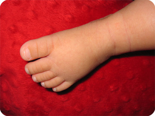 chaeli-foot1.jpg